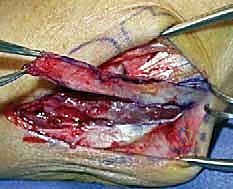 التخطيط الجراحي