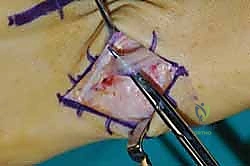 Clinical Image