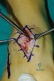 Clinical Image