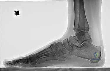 Clinical Image