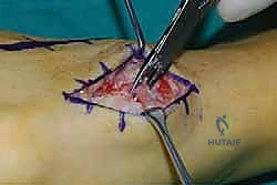 Clinical Image