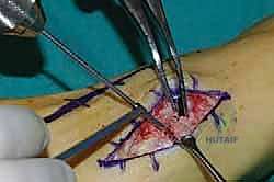 Clinical Image