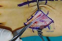 Clinical Image