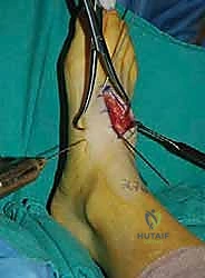 Clinical Image