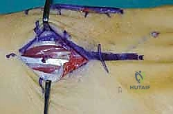Clinical Image
