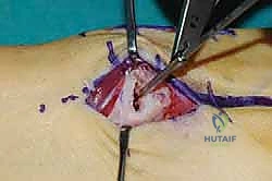 Clinical Image