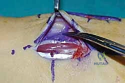 Clinical Image