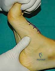 Clinical Image