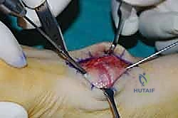 Clinical Image