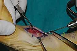 Clinical Image