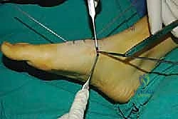 Clinical Image