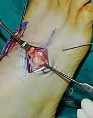 Clinical Image
