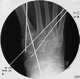 Clinical Image