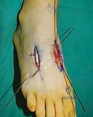 Clinical Image