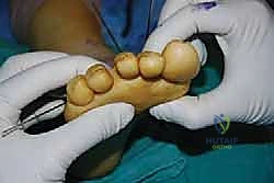 Clinical Image