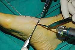 Clinical Image