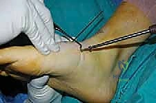 Clinical Image