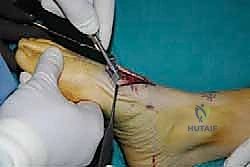 Clinical Image
