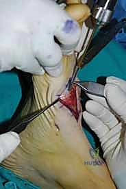 Clinical Image