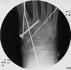 Clinical Image