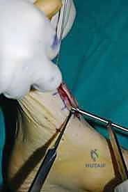 Clinical Image
