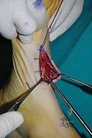 Clinical Image