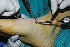 Clinical Image