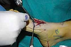 Clinical Image