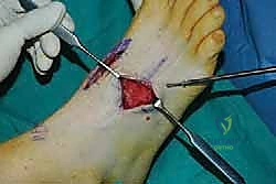 Clinical Image