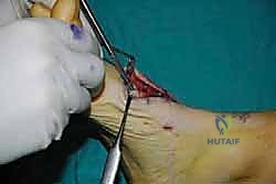 Clinical Image