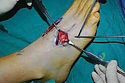 Clinical Image