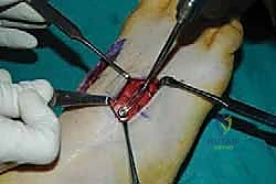Clinical Image