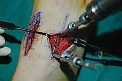 Clinical Image