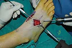 Clinical Image