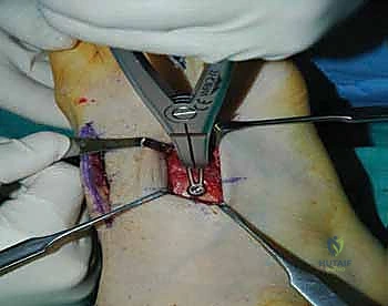 Clinical Image