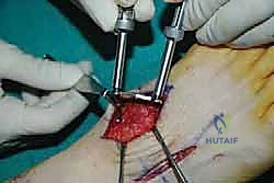 Clinical Image