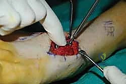 Clinical Image