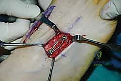 Clinical Image