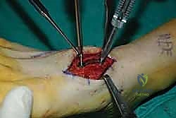 Clinical Image