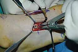 Clinical Image