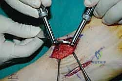 Clinical Image