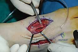 Clinical Image