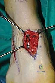 Clinical Image
