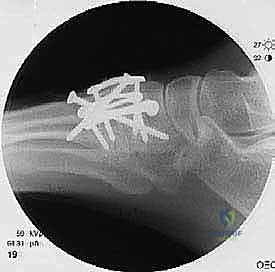 Clinical Image