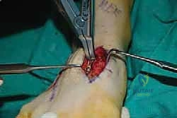 Clinical Image