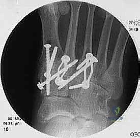 Clinical Image