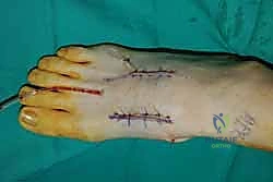 Clinical Image