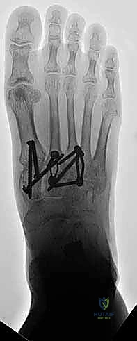 Clinical Image