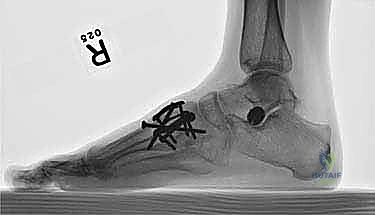 Clinical Image