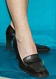 Clinical Image